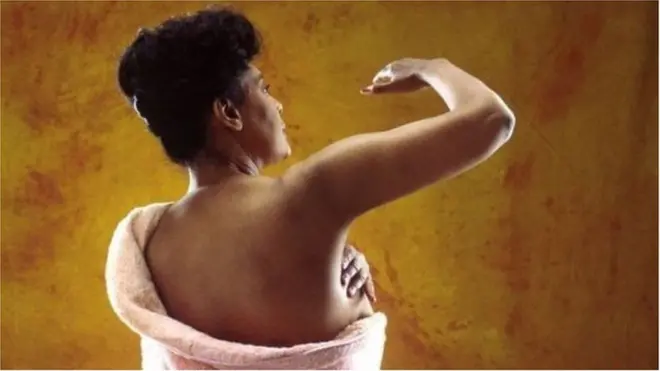 బ్రెస్ట్ క్యాన్సర్