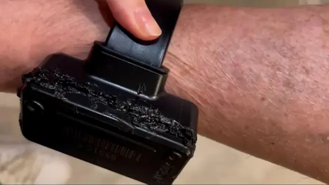 Imagem de uma tornozeleira eletrônica preta com sinais de derretimento. 