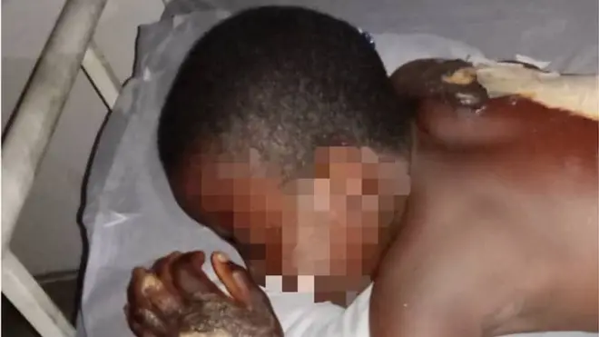 Pikin wey madam pour hot water on top im body