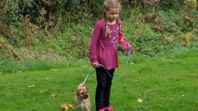 Un video de Isabella recibiendo su primer brazo prostético se hizo viral.