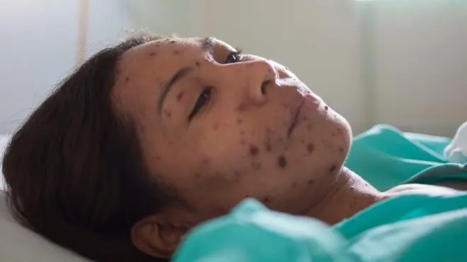 Itoophiyaatti Gifirrii lubbuu namaa galaafachaa jira