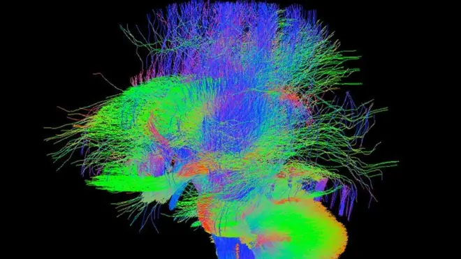 Imagen por resonancia magnética que muestra las conexiones en un cerebro en desarrollo. Las imágenes publicadas ahora por el equipo científico corresponden a 40 bebés y fueron tomadas unos días después de nacer.