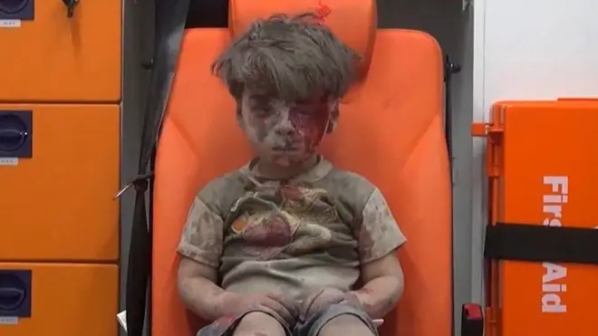 Mvulana Omran mwenye umri wa miaka minne