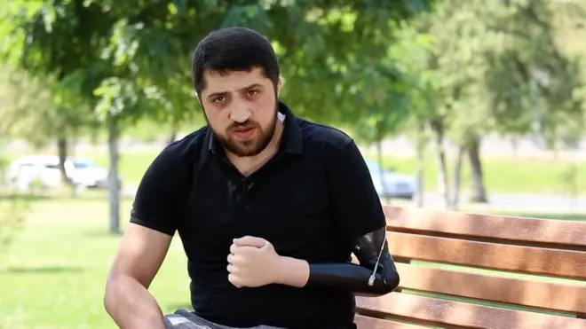 Ermənistan paytaxtı Yerevanda yaşayan Vladimr Vardanyan İkinci Qarabağ müharibəsində könüllü iştirak edib. O, döyüşlərdə bir qolunu itirib.