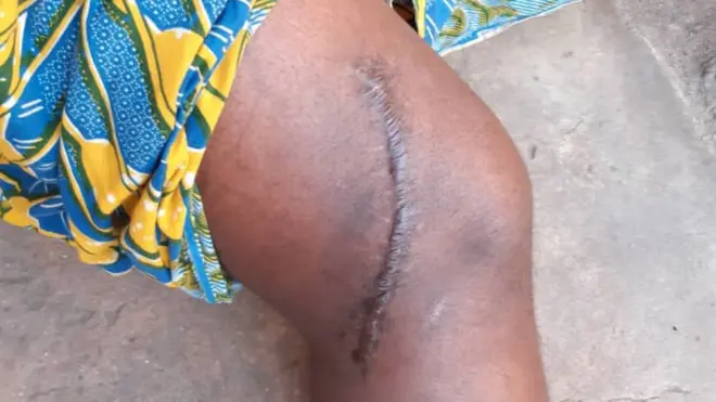 wanawake Kigoma watoroka 'teleza'