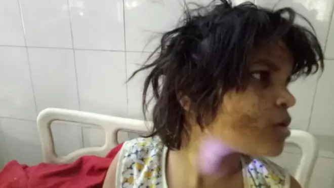 Dokter mengatakan anak perempuan yang ditemukan di hutan ini tidak mampu berkomunikasi dan memperlihatkan 'ciri-ciri seperti kera'.