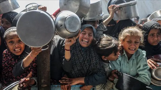 الجوع في غزة