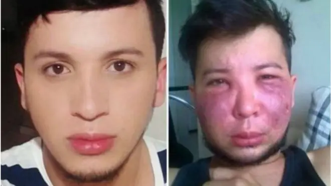 प्लास्टिक सर्जरी