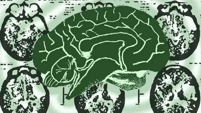 До конца не известно, что именно выхывает синдром Котарда который заставляет людей верить, что они умерли или лишились органов