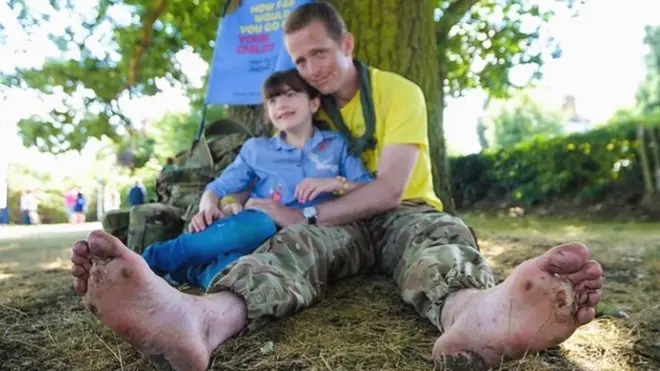 Hasti pictured with her dad - injuries to his feet visible