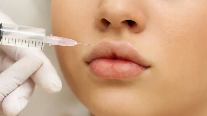 يمنع القانون في إنجلترا إجراء عمليات حقن "تجميلي" للجلد لمن دون 18 عاما، لكن "ليف" تمكنت من إجراء أول عملية لها في سن 16 عاما.