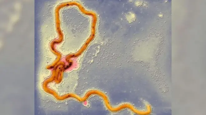 梅毒について話をしよう　英国で感染増加