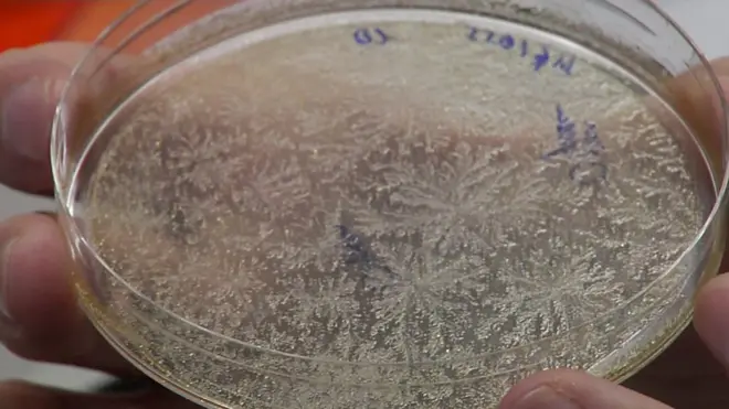 bacteria