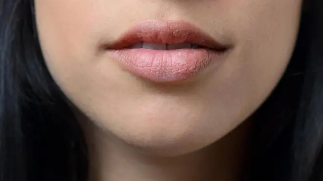 Orang orang yang tidak bisa tersenyum.