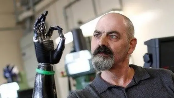 Протез Найджела Экланда позволяет выполнять различные движения, хотя и уступает настоящей руке человека