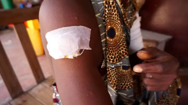 victim in togo demonstration