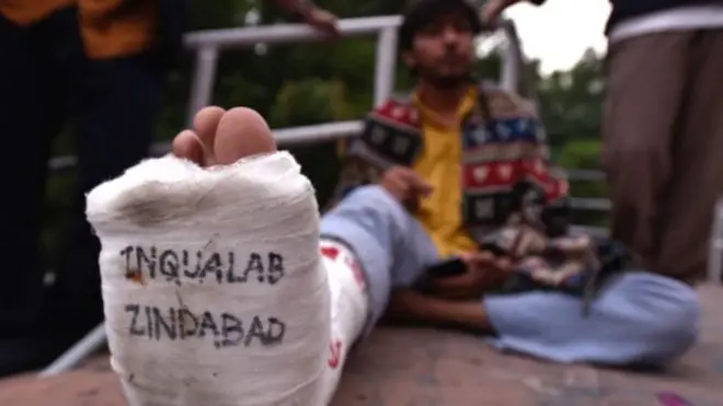 घायल छात्र