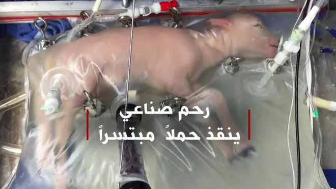 رحم اصطناعي