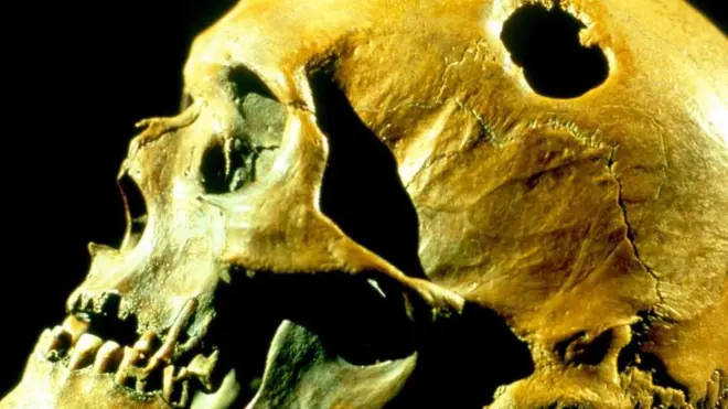 چرا اجداد ما جمجمه همدیگر را سوراخ می‌کردند