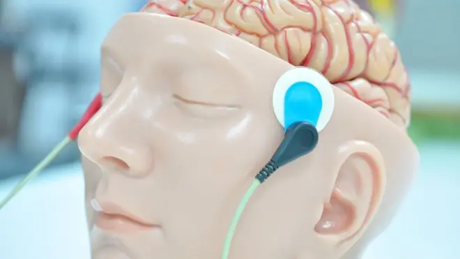 贴附有电极的大脑模型