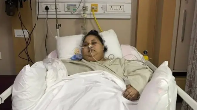 Ex-mulher mais gorda do mundo morre após perder mais300 kg | Saifee Hospital