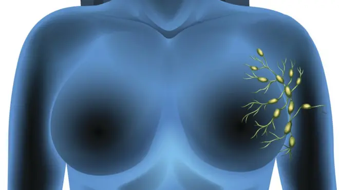 Algunos de los ganglios centinelas del sistema linfático están ubicados alrededor de las glándulas mamarias en hombres y mujeres.