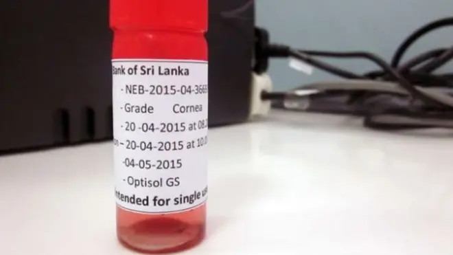 ඇස්