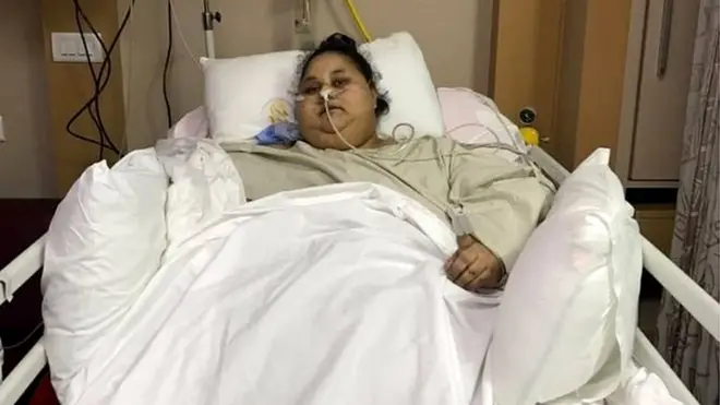 آپریشن سے قبل ان کا وزن 500 کلوگرام بتایا جاتا تھا اور خیال ہے کہ وہ دنیا کی وزنی ترین خاتون ہیں