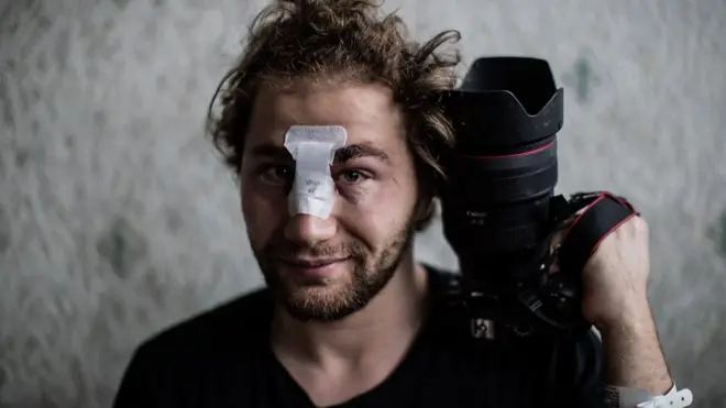 أمير الحلبي