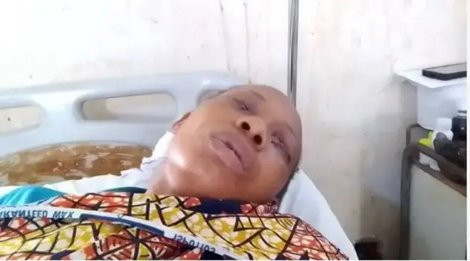 Amarachi lórí ìbùsùn ilé ìwòsàn