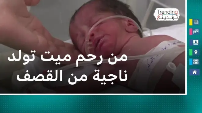 صابرين جودة.. إنقاذ الرضيعة الغزية من رحم أمها التي قتلت بالقصف