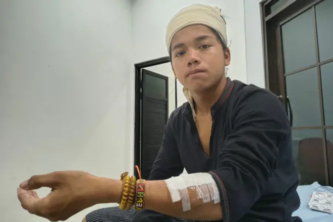 Repan, warga suku Baduy Dalam yang dibegal sekelompok orang tak dikenal pada akhir Oktober lalu, memperlihat bekas luka akibat sabetan benda tajam di tangan kiri pada Kamis (6/11).