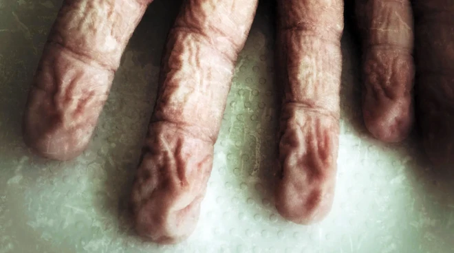 쭈글쭈글한 손가락