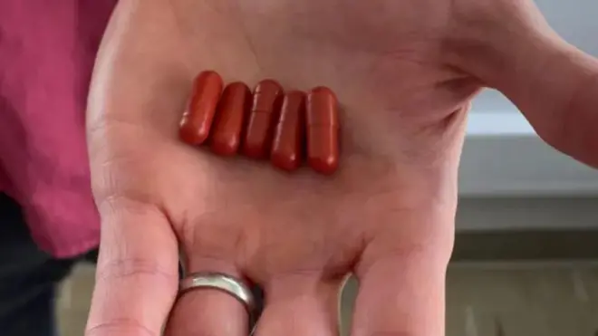 Five dark red pill capsules being held in the palm of a doctor's hand