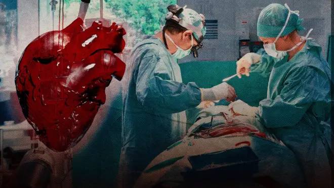 операция на сердце