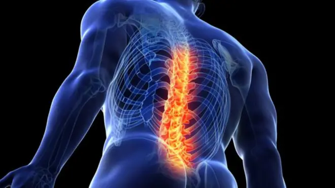 পিঠে ব্যথা