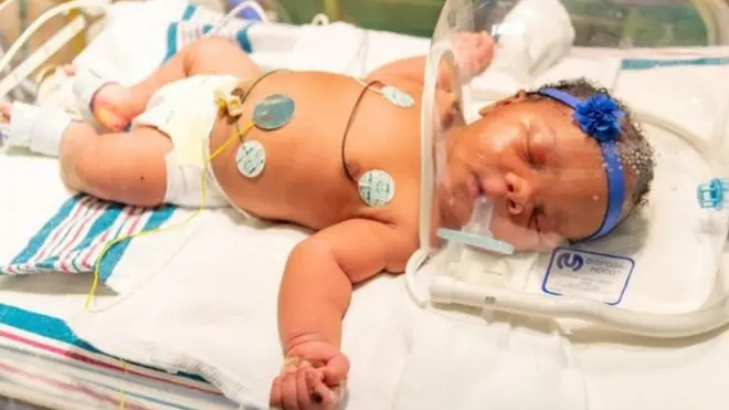 Aworan aramọ́nda ọmọ