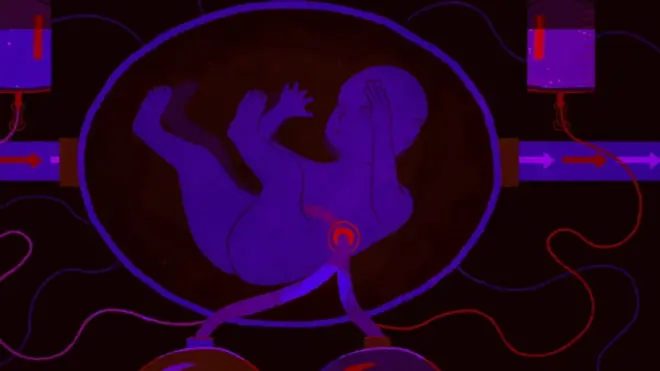 ఇల్లస్ట్రేషన్