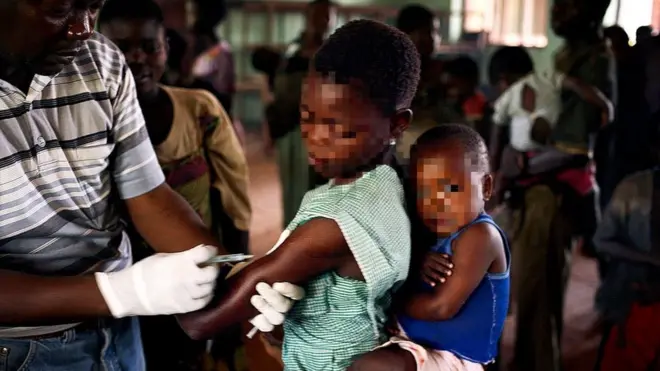 ኩፍኝ ዲሞክራቲክ ኮንጎ ውስጥ '2700 ህፋናትን ገደለ'