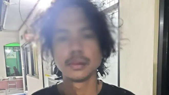 Foto wajah MF babak belur setelah disiksa selama delapan jam. Pipi kiri bengkak dan ada luka robek di bibir. 