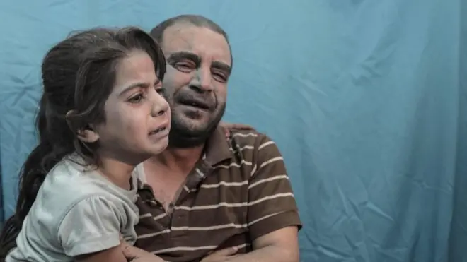 Palestinians wounded in an Israeli bombardment are treated in a hospital in Khan Younis