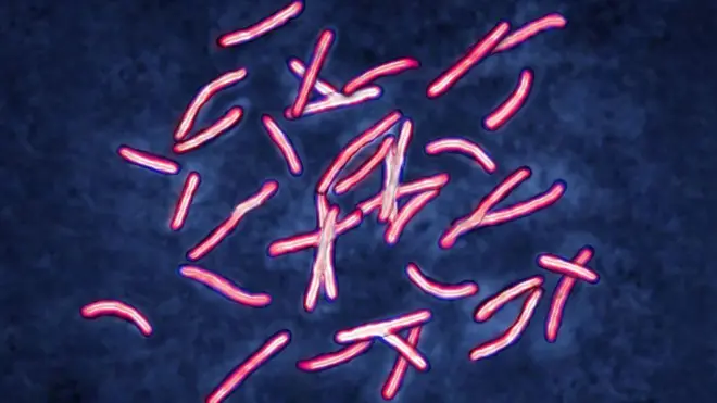 A quoi ressemble la tuberculose au microscope. Il y a une trentaine de longs germes blancs ressemblant à des vers, avec un extérieur rouge et des lignes rouges au milieu.