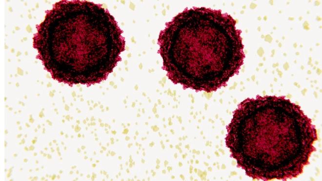 La poliomelitis ha sido prácticamente erradicada desde que muchas naciones iniciaron campañas de vacunación masiva para prevenirla.