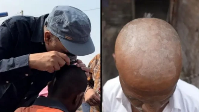 ટાલ, બુલઢાણા, હરિયાણા, સેલેનિયમનો અભાવ, બીબીસી ગુજરાતી, બીબીસી ન્યૂઝ ગુજરાતી 