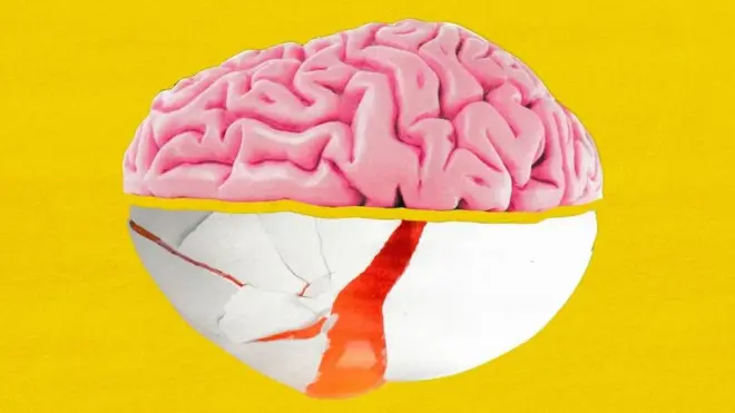 Ilustración de un cerebro y un huevo