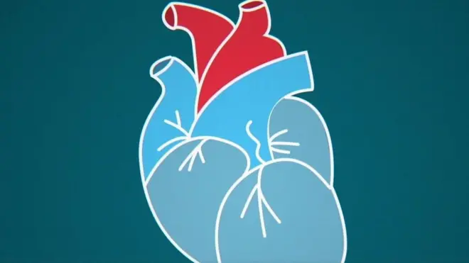 Ща таке інфаркт і як його уникнути