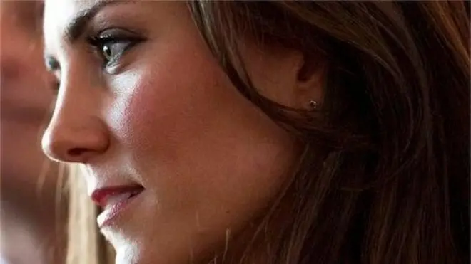 The Duchess of Cambridge suffered from the extreme form of morning sickness during her three pregnancies