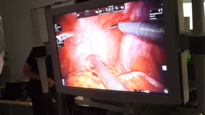 nova metoda otkrivanja kanceroznih ćelija