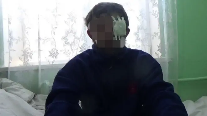 Бойовик із Авдіївки