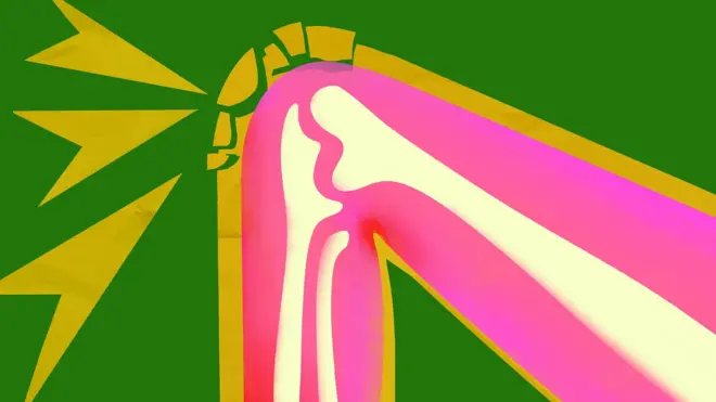 Схематичний малюнок коліна